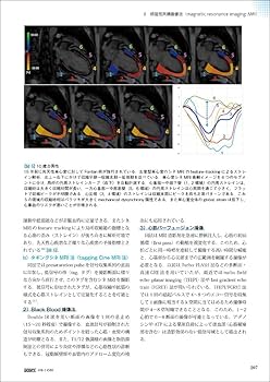 新 発達心臓病学 | 中西 敏雄, 先崎 秀明, 山岸 敬幸 |本 | 通販 | Amazon