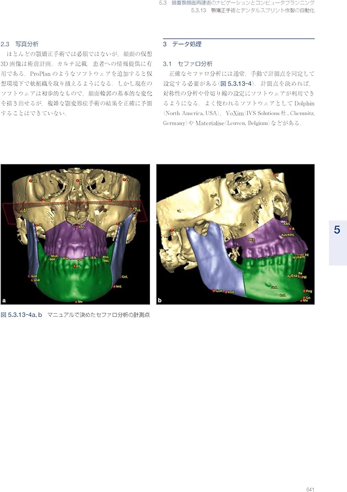 AO法骨折治療 アドバンスト頭蓋顎顔面手術: 腫瘍、骨矯正、外傷 | 下郷