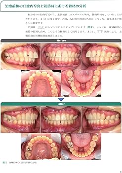 実践的リンガルブラケット矯正 | 松野 功 |本 | 通販 | Amazon