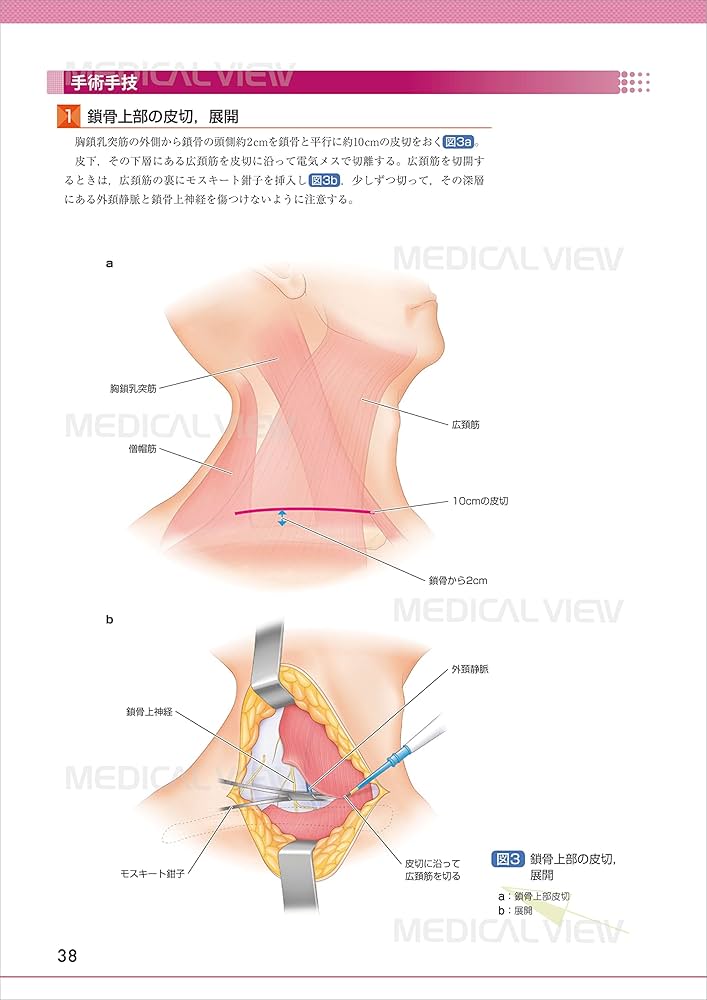 末梢神経障害・損傷の修復と再建術 (OS NEXUS(電子版付き) 17) | 岩崎