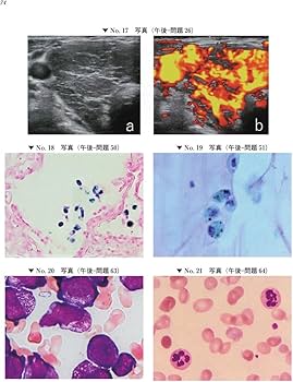 臨床検査技師国家試験問題集 2020年版 | 日本臨床検査学教育協議会 |本