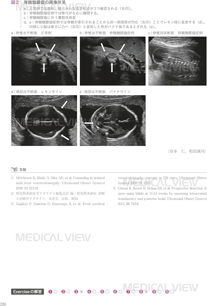 専門医を目指す 周産期診療ワークブック−第3版 : 日本周産期・新生児