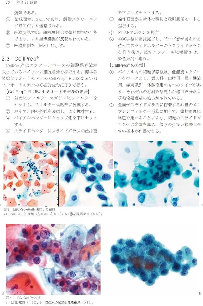 実践細胞診テキスト 改訂版 ―初心者からエキスパートまで | 南雲