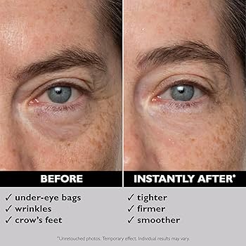 Amazon.com: Peter Thomas Roth | Instant FIRMx® Eye Temporary Eye
