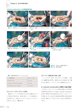 世界基準の臨床歯内療法 第2版 | 石井 宏, 石井 宏 |本 | 通販 | Amazon