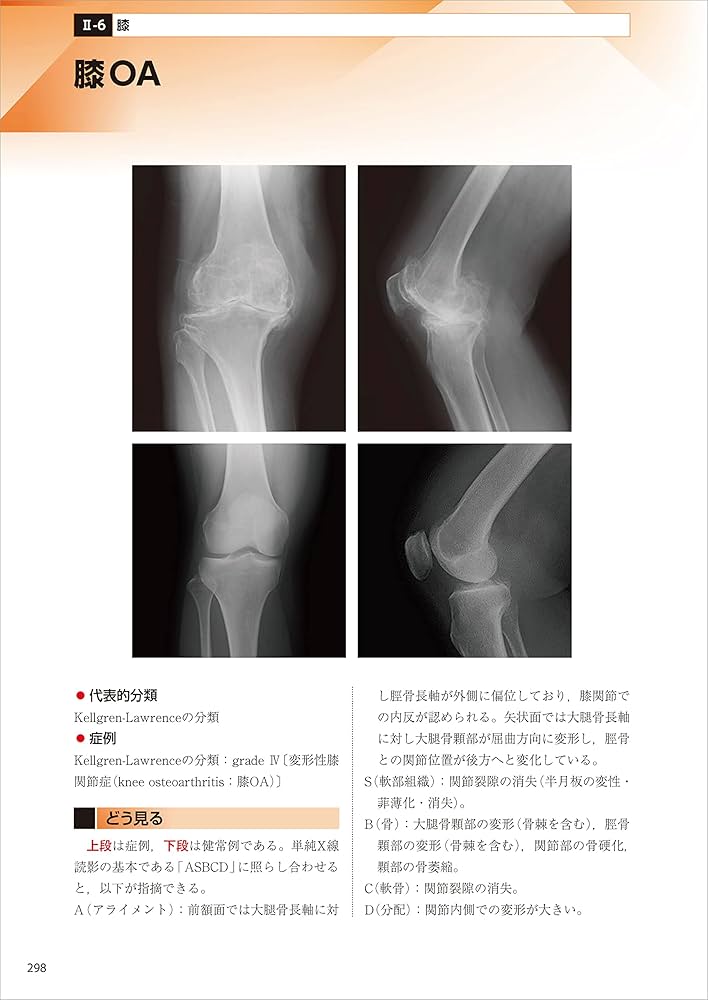 運動療法に役立つ単純X線像の読み方−改訂第2版 | 青木 隆明, 浅野