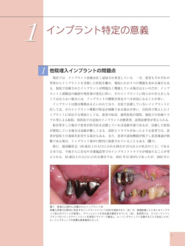 インプラント判別ガイド | 竹島 明道, 田島 聖士 |本 | 通販 | Amazon
