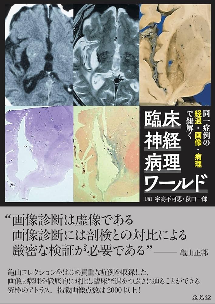 同一症例の経過・画像・病理で紐解く 臨床神経病理ワールド | 宇高不可