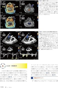 理解して使いこなす麻酔科機器 (麻酔科プラクティス 9): モニター・ICU