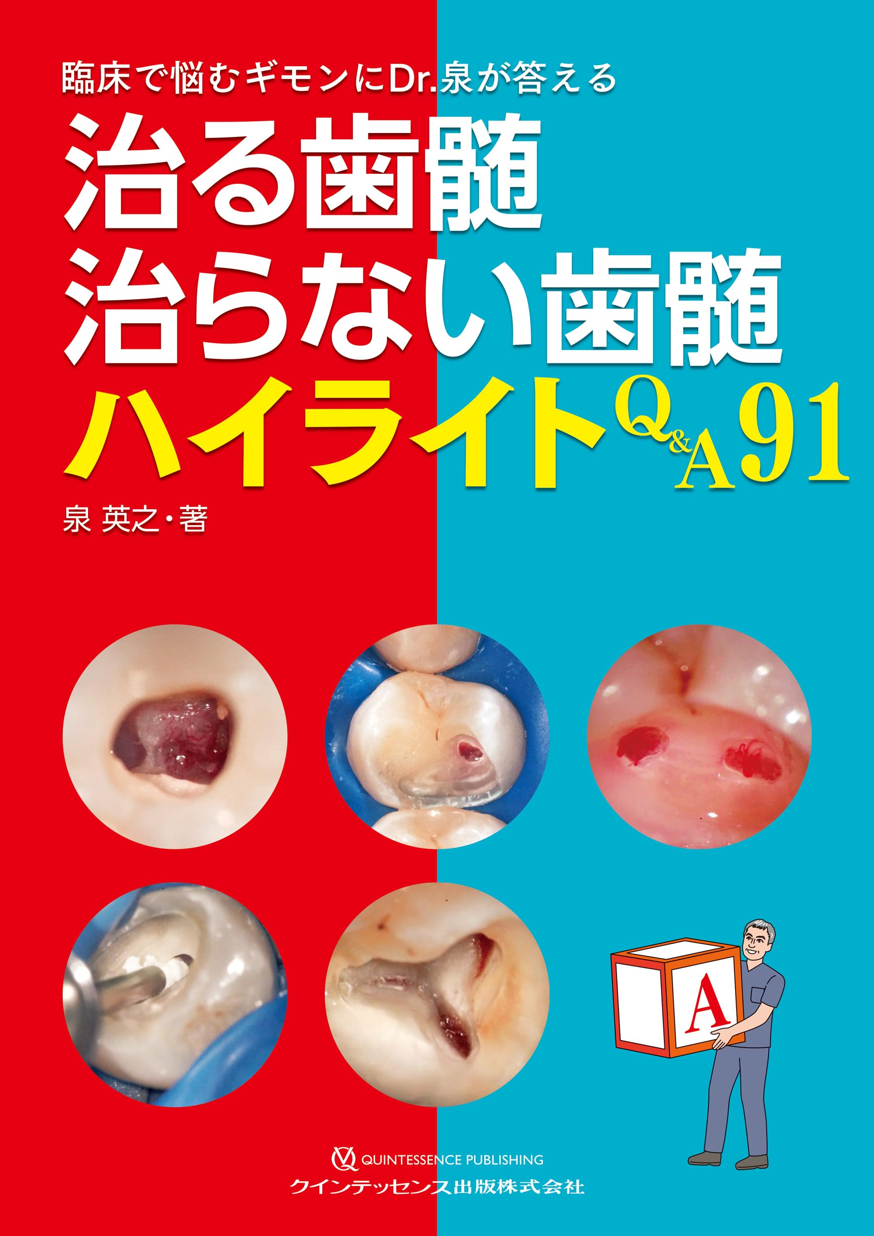 治る歯髄 治らない歯髄 ハイライトQ&A91: 臨床で悩むギモンにDr.泉が