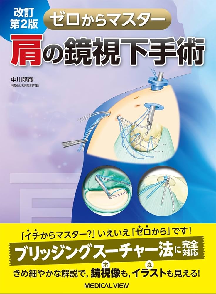 肩の鏡視下手術 改訂第2版 (ゼロからマスター) | 中川 照彦 |本 | 通販