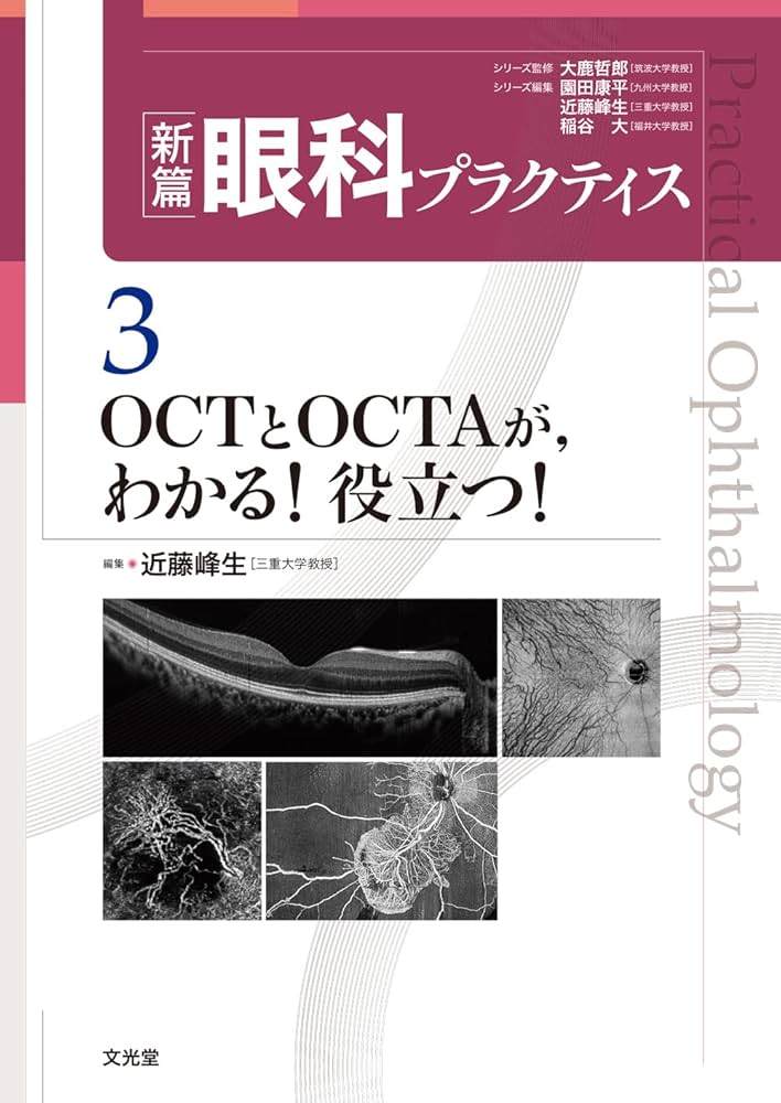 OCTとOCTAが,わかる!役立つ! (新篇眼科プラクティス 3) | 近藤峰生 |本