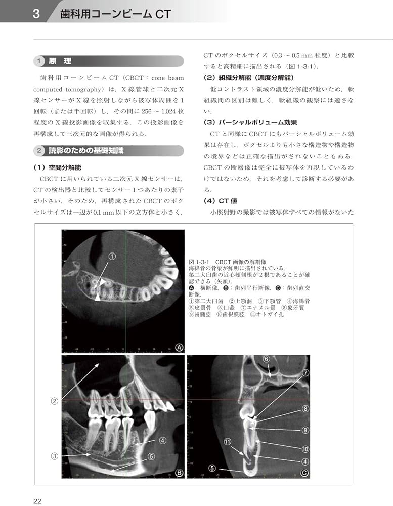 歯科臨床における画像診断アトラス 第2版 | 日本歯科放射線学会 |本