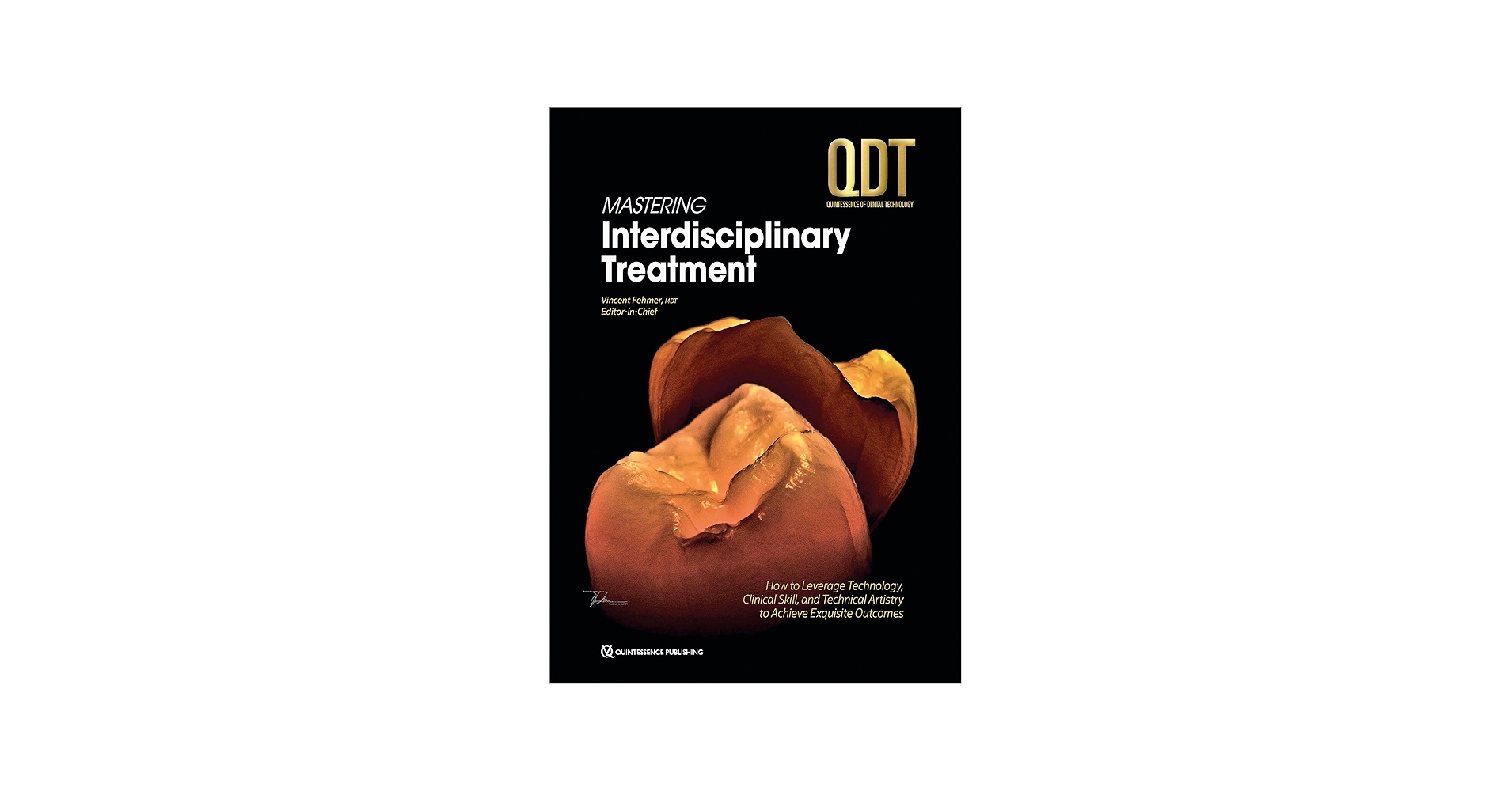Mastering Interdisciplinary Treatment; Quintessenc of Dental