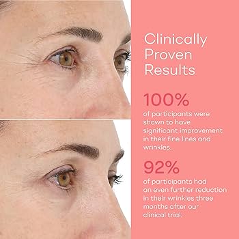 Amazon.com: LightStim for Wrinkles LED Red Light Therapy with 72