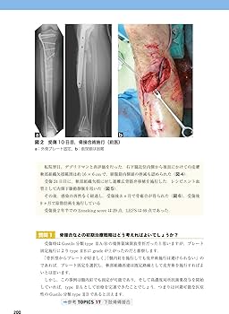 重度四肢外傷治療の奥義 | 土田芳彦 |本 | 通販 | Amazon