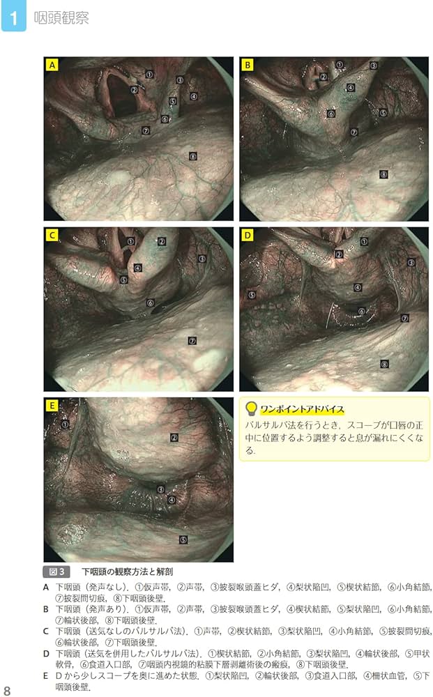 こんなときどうする!? 食道癌・咽頭癌 内視鏡の達人たちによる診断と