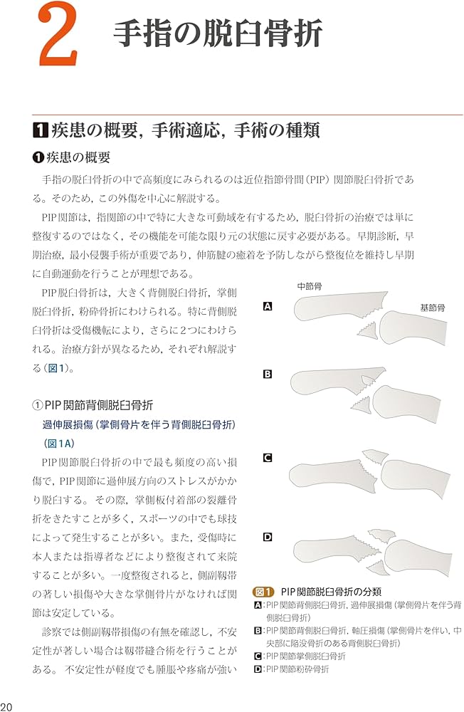 手外科手術ノート part2：代表的な骨折・外傷編 | 大井宏之 |本 | 通販