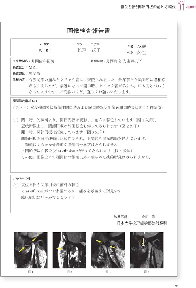 顎関節の画像診断: 臨床医によるMRI・CT読像の手引き | 金田 隆, 箕輪