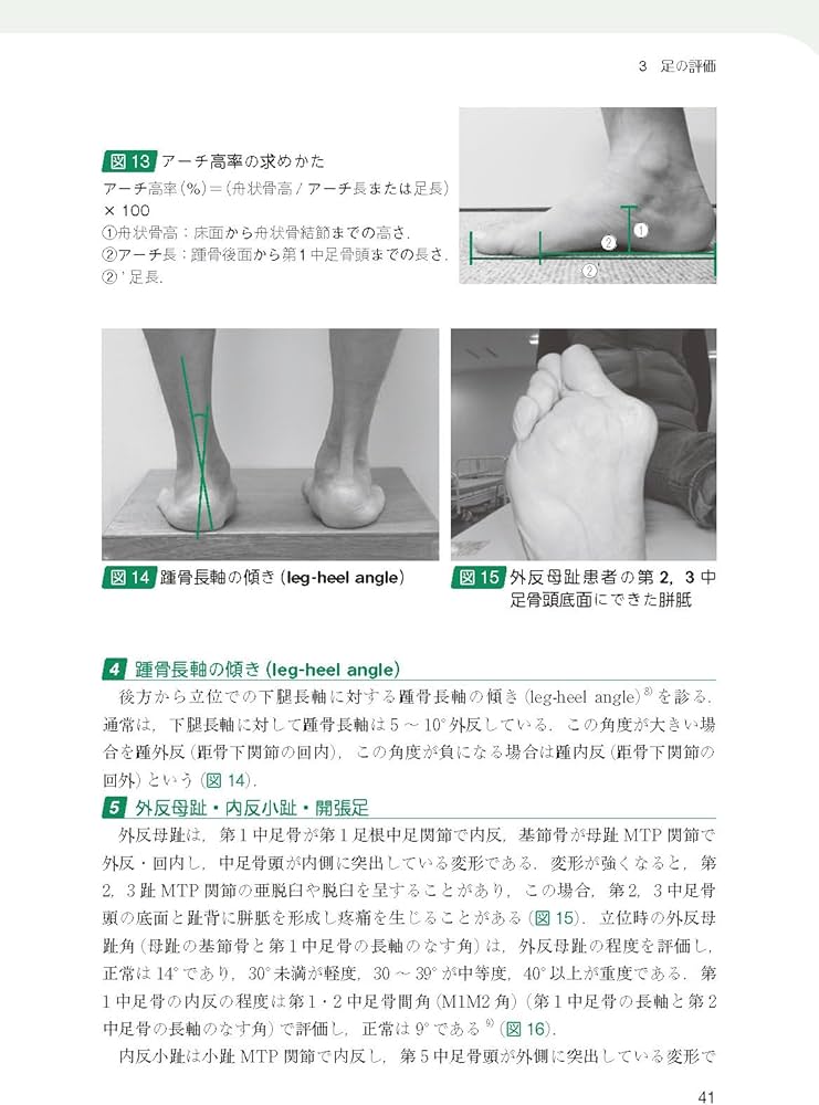 リハビリテーションのための足と靴のみかた 改題第2版 | 坂口 顕 |本