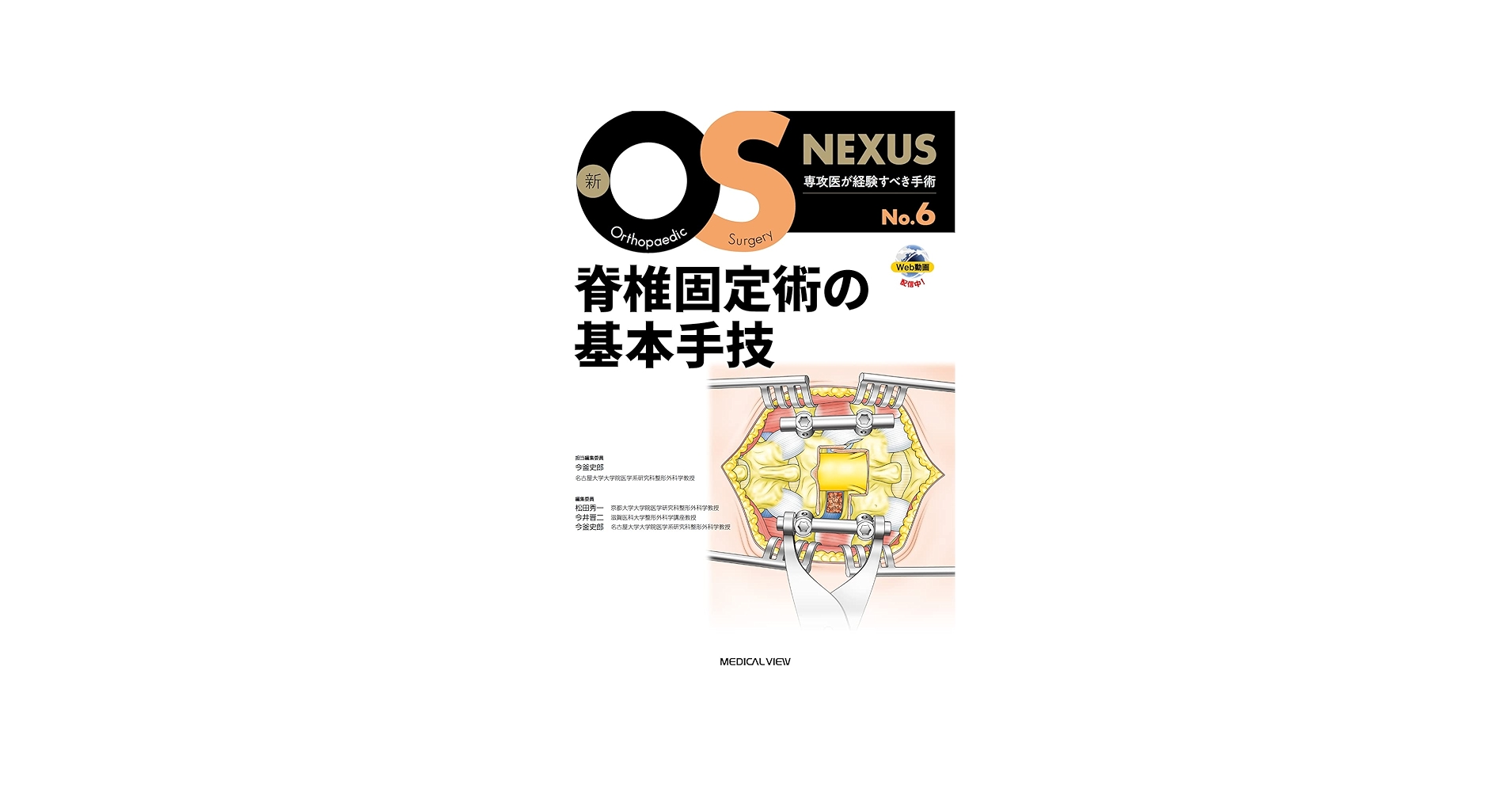 脊椎固定術の基本手技［Web動画付］ (新OS NEXUS No.6) | 今釜 史郎