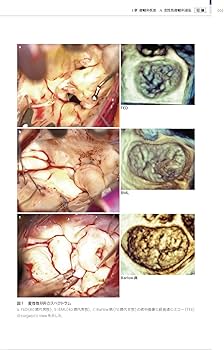 心臓手術ビデオアトラス 手術手技と画像診断［Web動画付］ | 江石清行