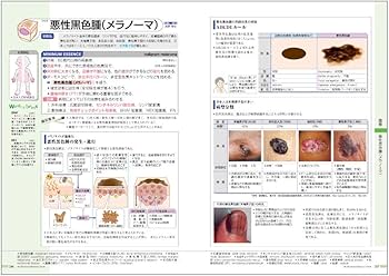 病気がみえる vol.14 皮膚科 第1版 | 医療情報科学研究所 |本 | 通販