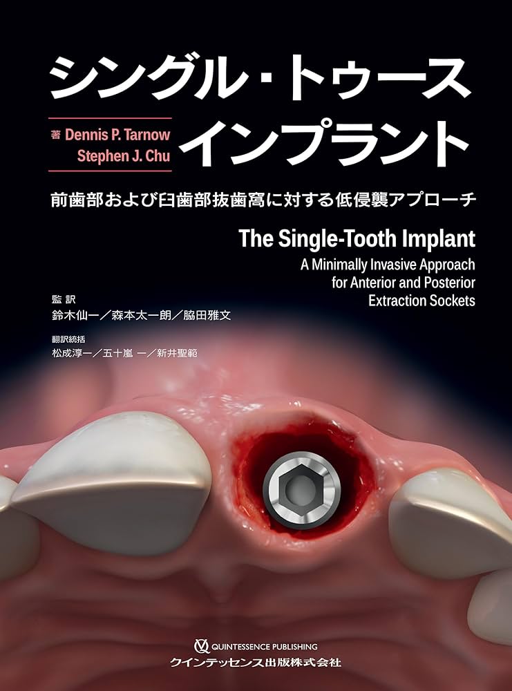 シングル・トゥースインプラント: 前歯部および臼歯部抜歯窩に対する低