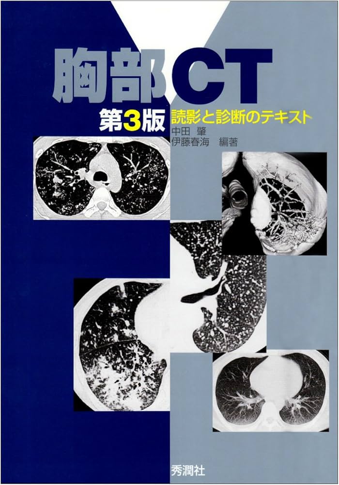 胸部CT: 読影と診断のテキスト | 中田 肇, 伊藤 春海 |本 | 通販 | Amazon