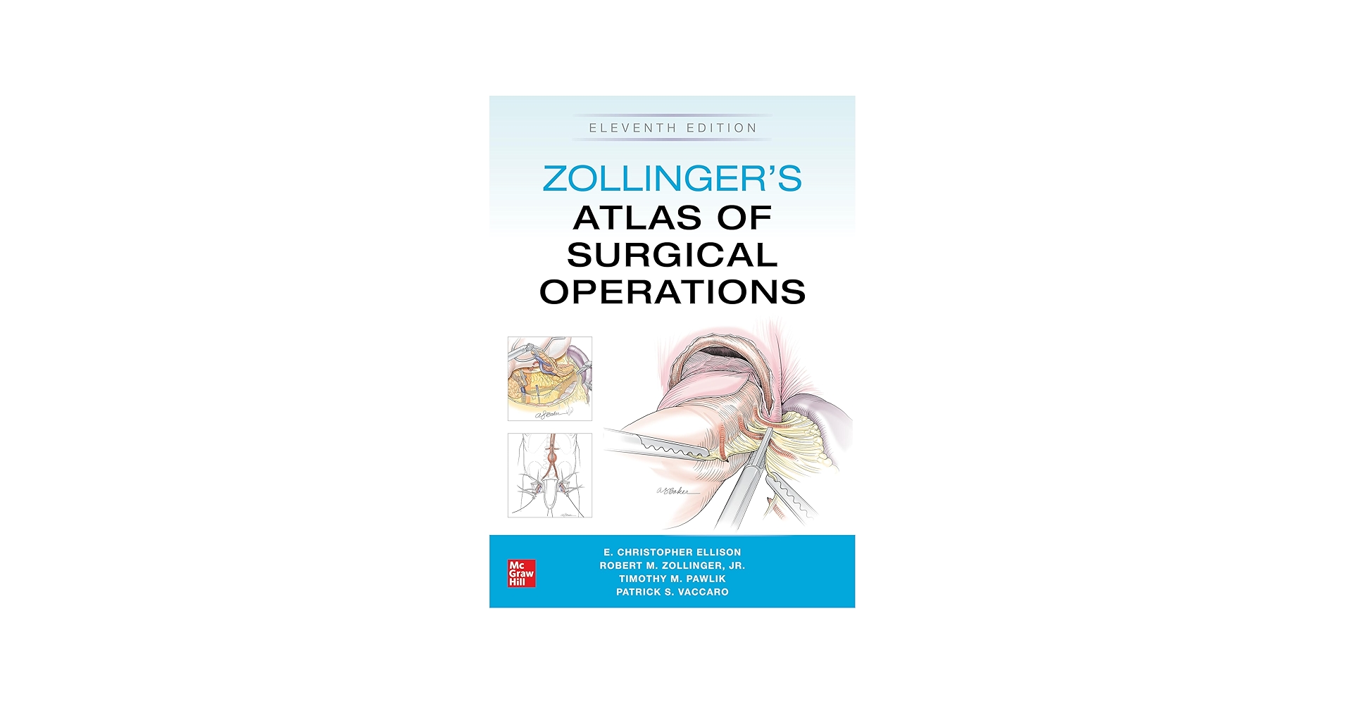 Zollinger's Atlas of Surgical Operations, Eleventh Edition