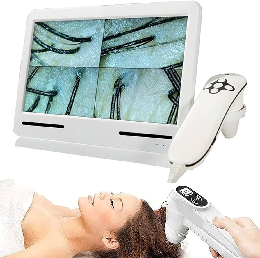 Amazon.co.jp : 皮膚毛頭皮検出器、皮膚診断毛髪アナライザー、10