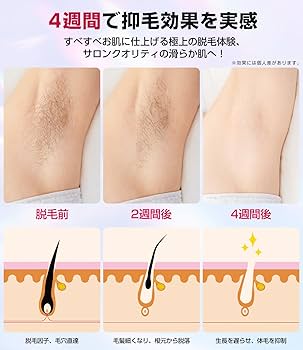 Amazon | 脱毛器 VIO対応【2024サロン級IPL光脱毛器】メンズ 髭