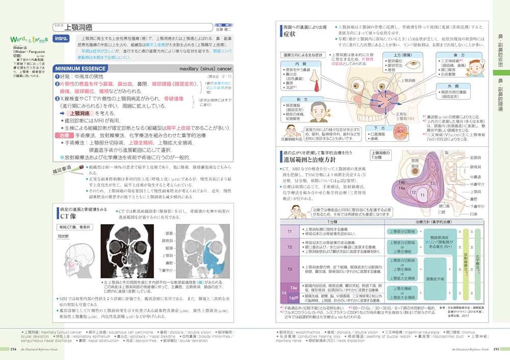 71hSpMNzHML._AC_UF1000,