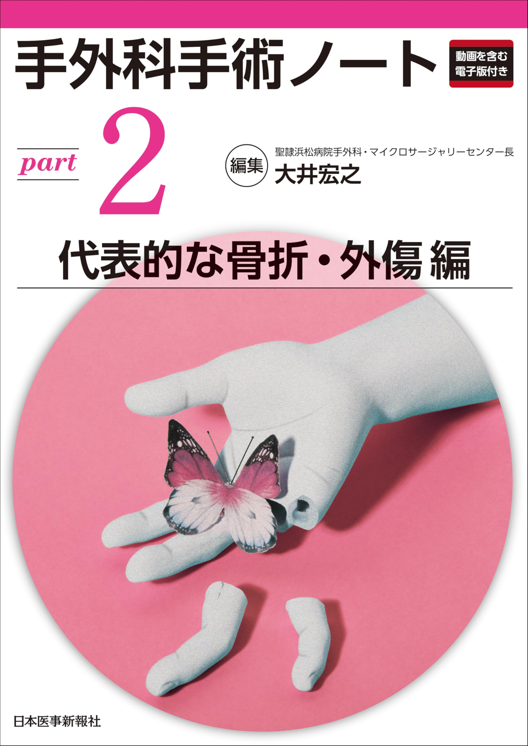 手外科手術ノート part2：代表的な骨折・外傷編 | 大井宏之 |本 | 通販