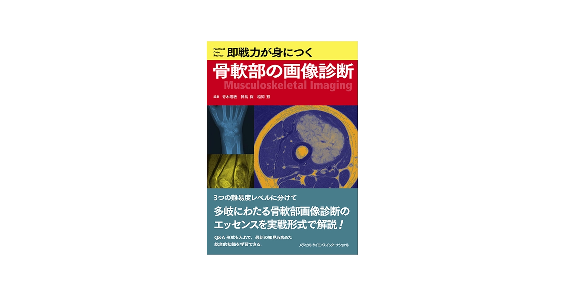 即戦力が身につく骨軟部の画像診断 | 青木隆敏, 神島 保, 稲岡 努 |本