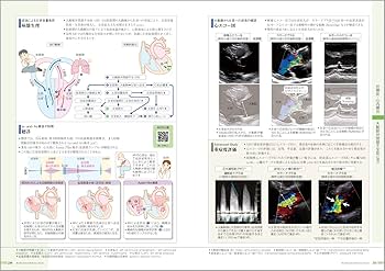 病気がみえる vol.2 循環器 第5版 | 医療情報科学研究所 |本 | 通販