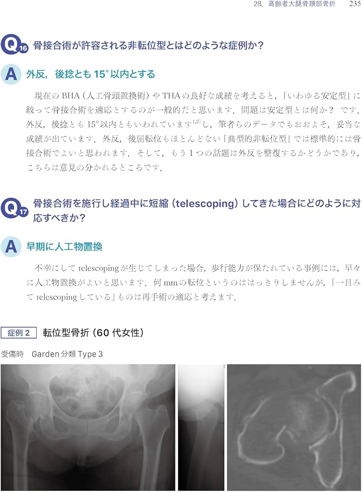 Amazon.co.jp: 「考える」外傷整形外科! : 土田 芳彦: 本