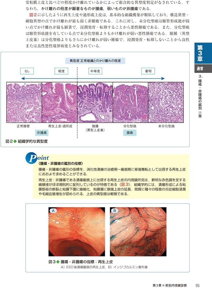 食道・胃腫瘍診断改訂版〜確実な鑑別・深達度診断のためのコツとCase