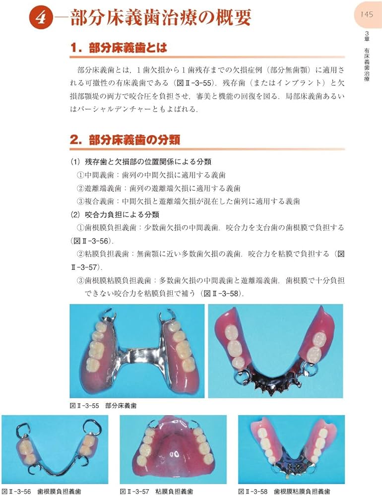 咀嚼障害・咬合異常1 歯科補綴 第2版 (最新歯科衛生士教本) | 全国歯科