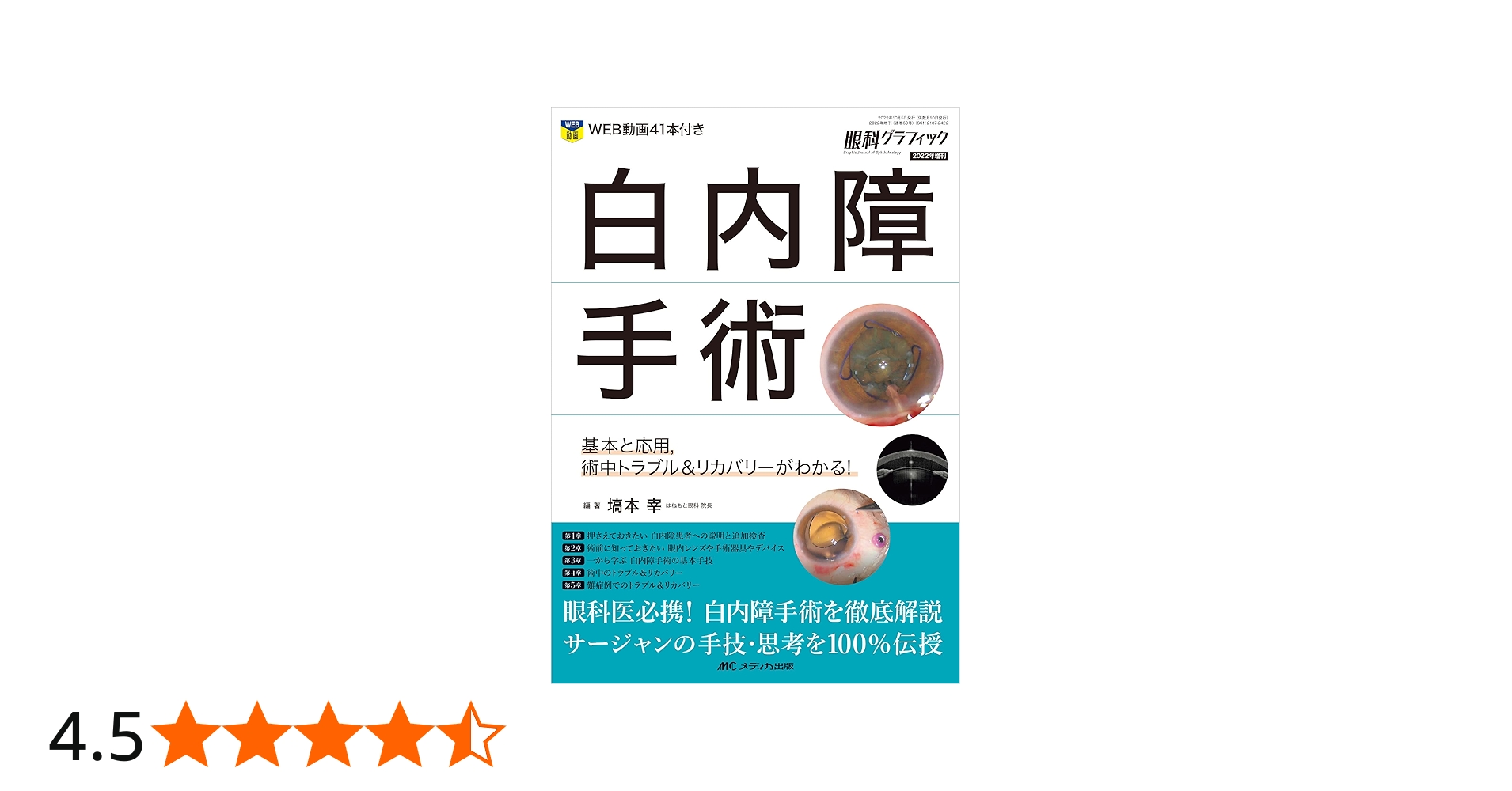 白内障手術: 基本と応用，術中トラブル＆リカバリーがわかる！ (眼科