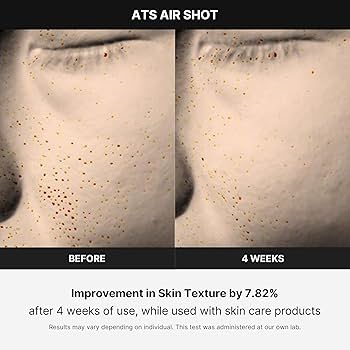 Amazon.com: Medicube Age-R ATS Air Shot - Microneedling Pore