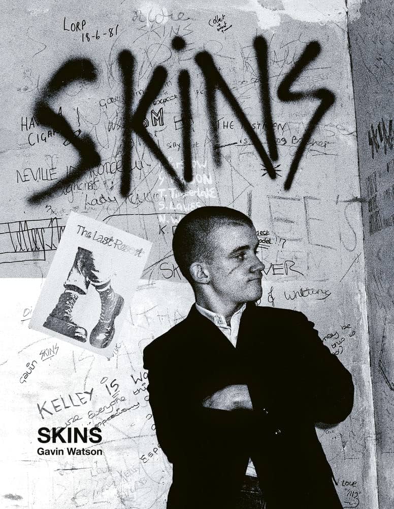 Amazon | Skins: Gavin Watson | Watson, Gavin | Lifestyle & Events