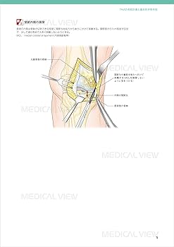 膝関節の再建手術 (新OS NEXUS No.1) | 松田 秀一 |本 | 通販 | Amazon