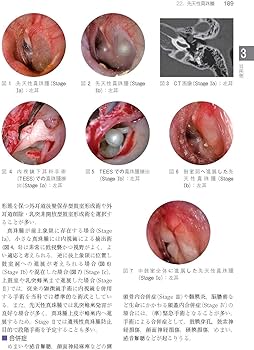 Amazon.co.jp: 今日の耳鼻咽喉科・頭頸部外科治療指針 第4版 : 森山 寛: 本