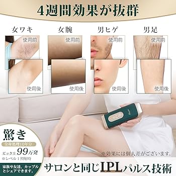 Amazon | 【サロン級IPL光脱毛器】Omuse 脱毛器 vio対応 髭 顔 ワキ