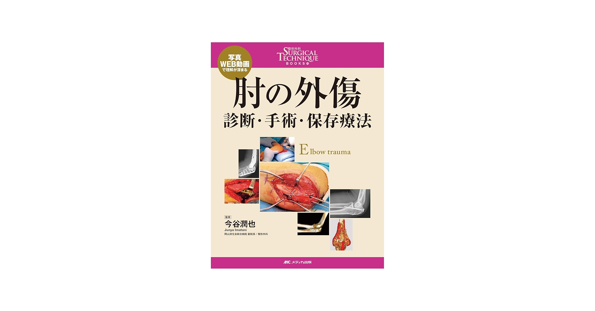 肘の外傷:診断・手術・保存療法 (整形外科SURGICAL TECHNIQUE BOOKS 11