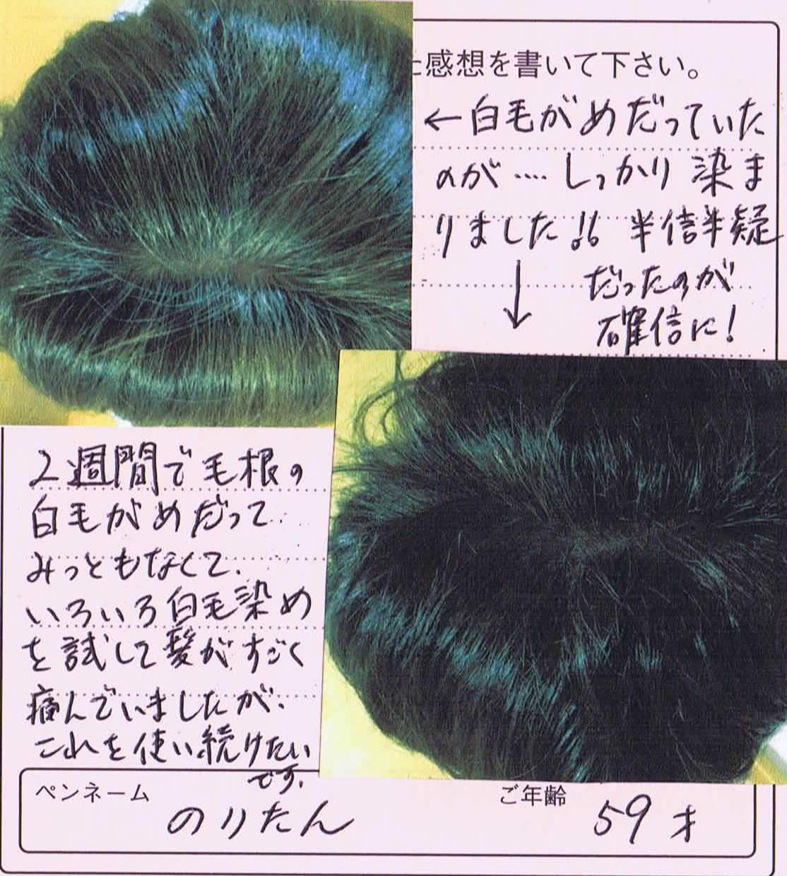 Amazon | タンドルージュ 白髪染め カラートリートメント ダーク