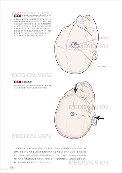 脳神経外科 ザ・ベーシック | 大宅 宗一 |本 | 通販 | Amazon