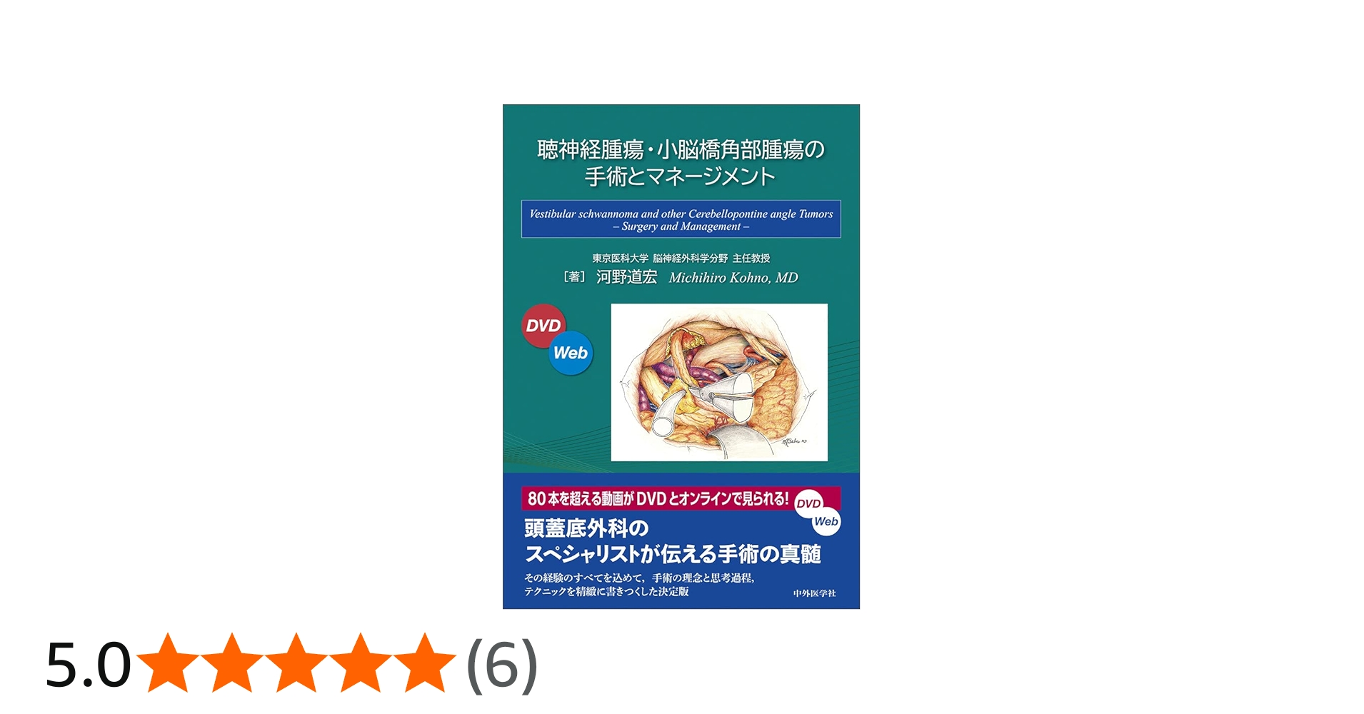 聴神経腫瘍・小脳橋角部腫瘍の手術とマネージメント | 河野 道宏 |本