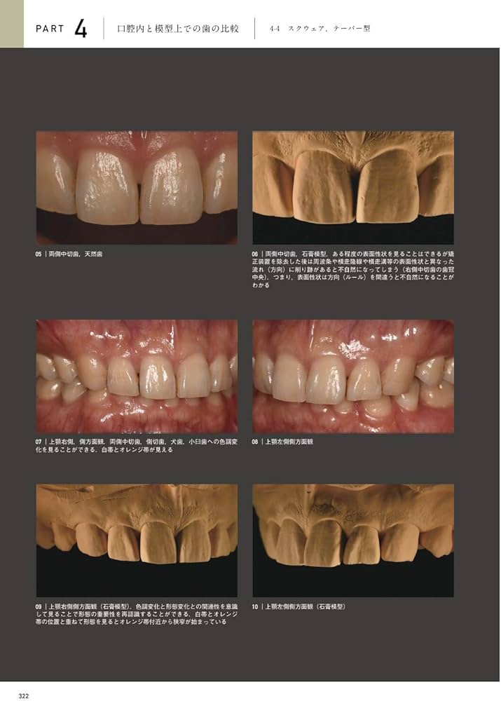 天然歯の形態学 2 | 脇田 太裕 |本 | 通販 | Amazon